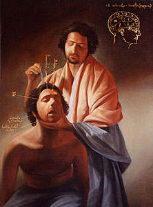 La Extracción De La Piedra De La Locura