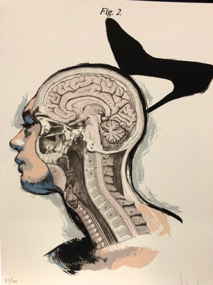 Fernando Vicente: La Belleza Chaud Froid II